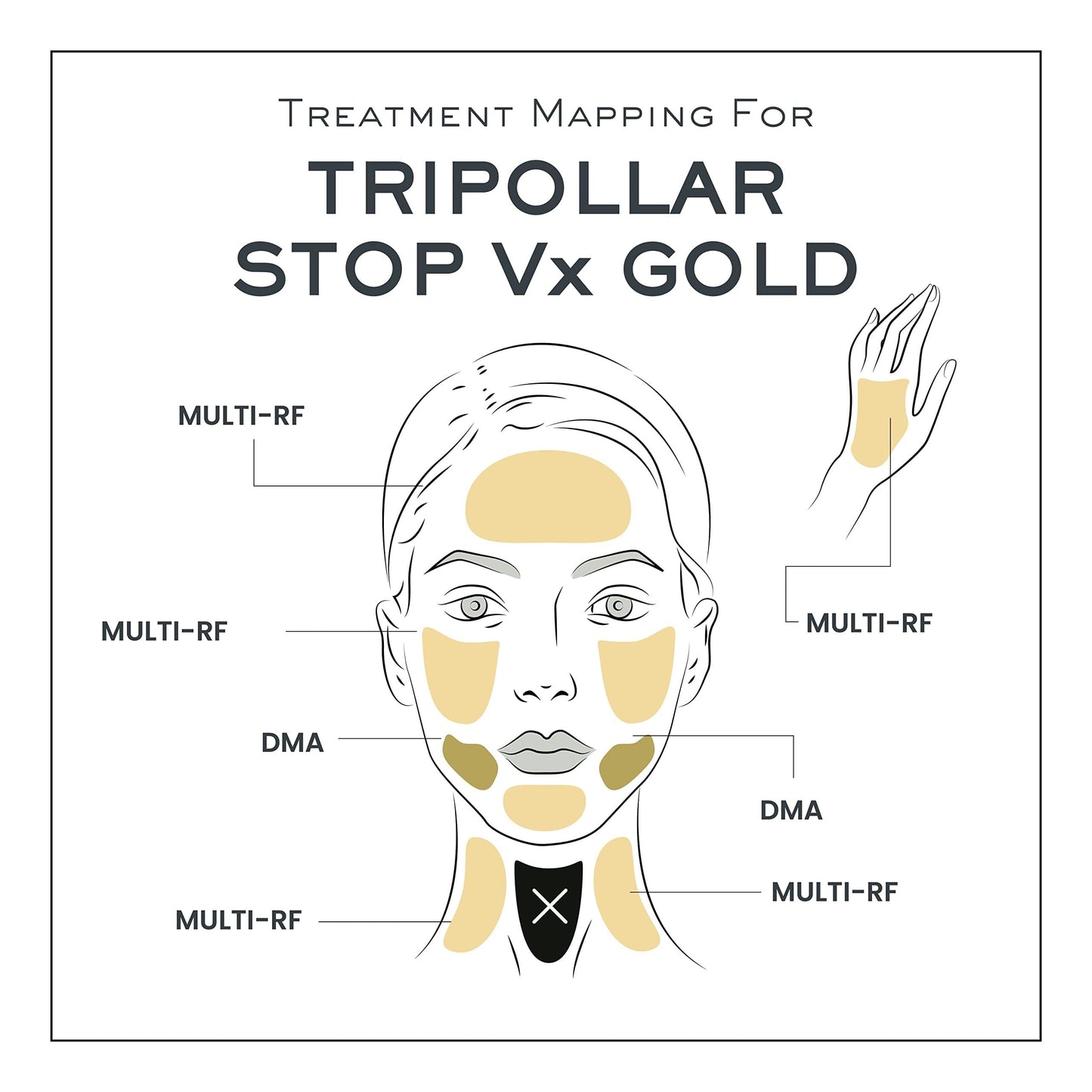 預購✅TRIPOLLAR 初普 STOP Vx 2 GOLD 金礦美容儀(含經典凝膠一個50ml)+ 2年保固