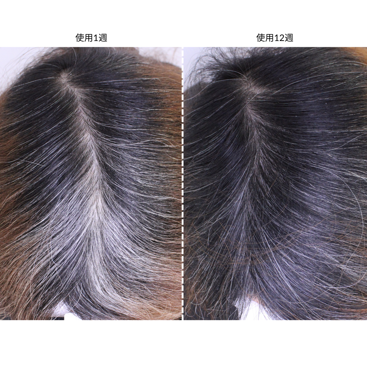 現貨✅CurrentBody Skin LED光療生髮帽+一年保固