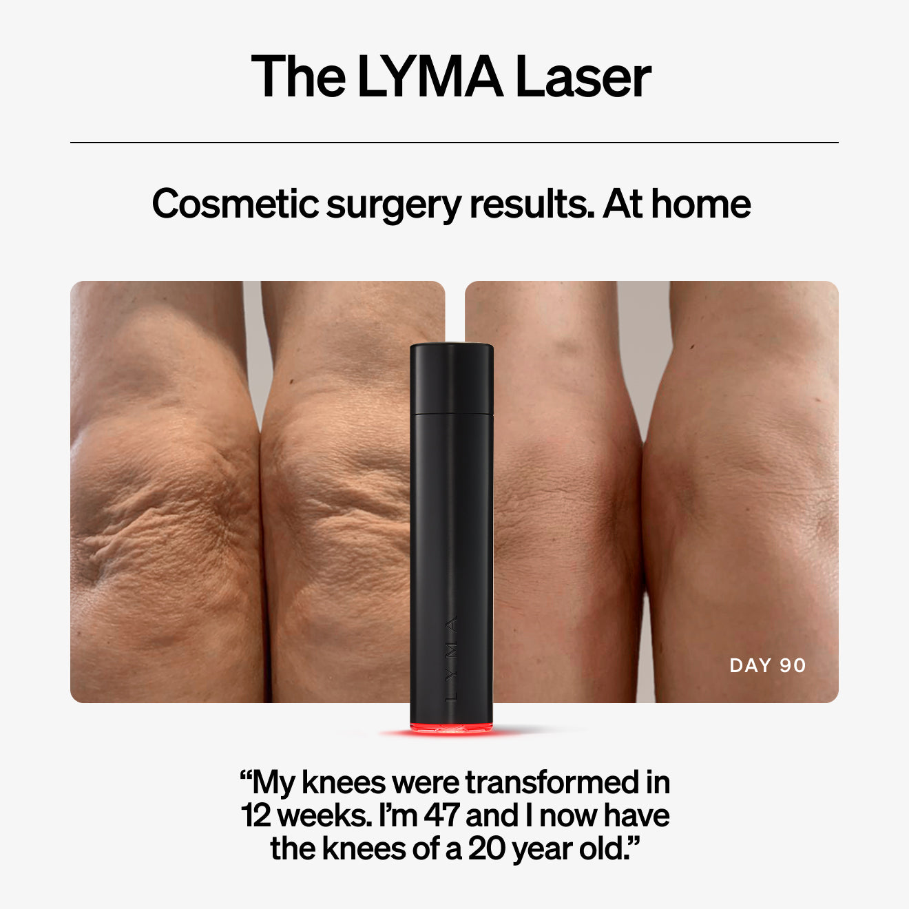 預購✅英國原廠 LYMA萊瑪光 家用活膚儀(500毫瓦)+台灣一年保固