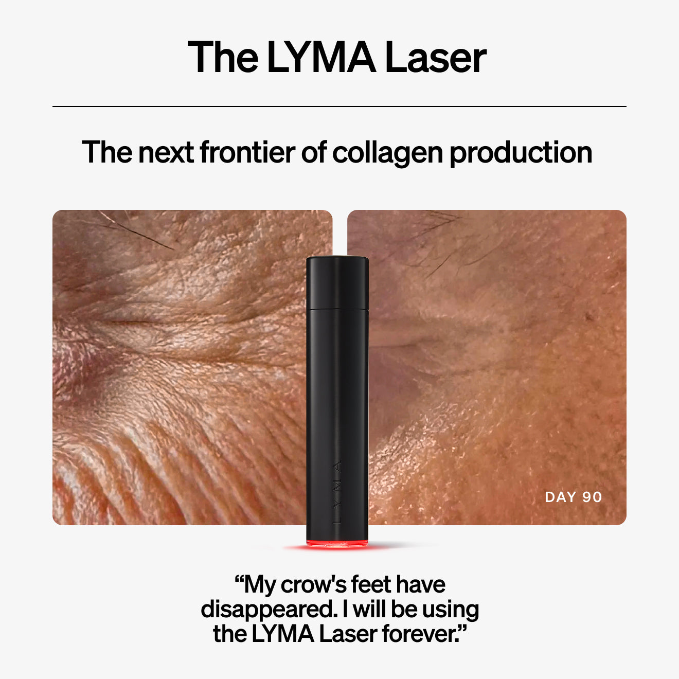 預購✅英國原廠 LYMA萊瑪光 家用活膚儀(500毫瓦)+台灣一年保固